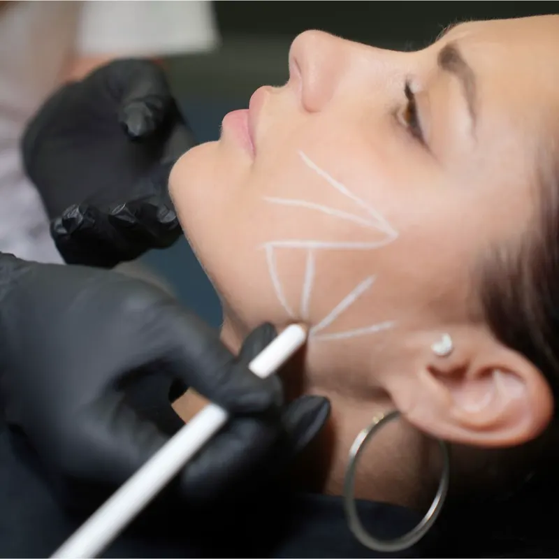 Harmonização Facial