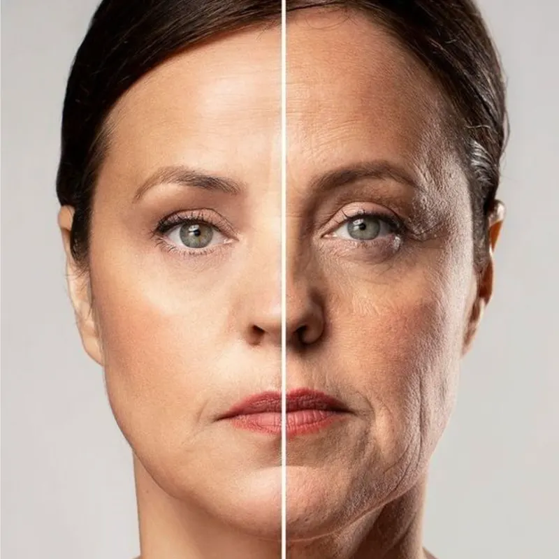 Lipoenxertia Facial